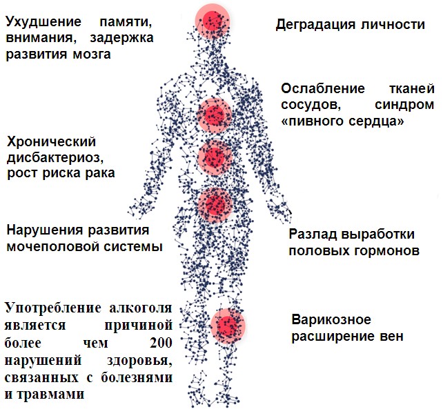 Куда бьет алкоголь