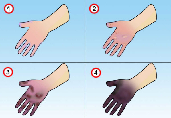 http://infomed.by/uploaddata/textimages/Pictures_articles/518cb60227920b52fd5b60c9bfb775ac.jpg